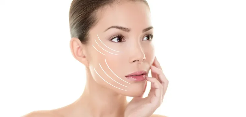 how long does a facelift last surgeon surgery face lift