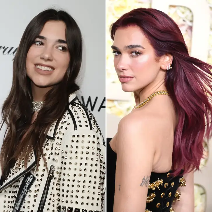 Dua Lipa Plastic Surgery before and after, opinions, & more Dua Lipa Plastic before after